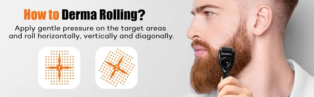 Micro Needling 540 Roller Derma Roller Dermaroller 0.2/0.25/0.3mm Titanium Hair Regrowth Beard Growth Anti-Hair Loss Treatment