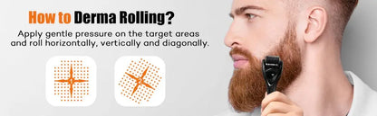 Micro Needling 540 Roller Derma Roller Dermaroller 0.2/0.25/0.3mm Titanium Hair Regrowth Beard Growth Anti-Hair Loss Treatment