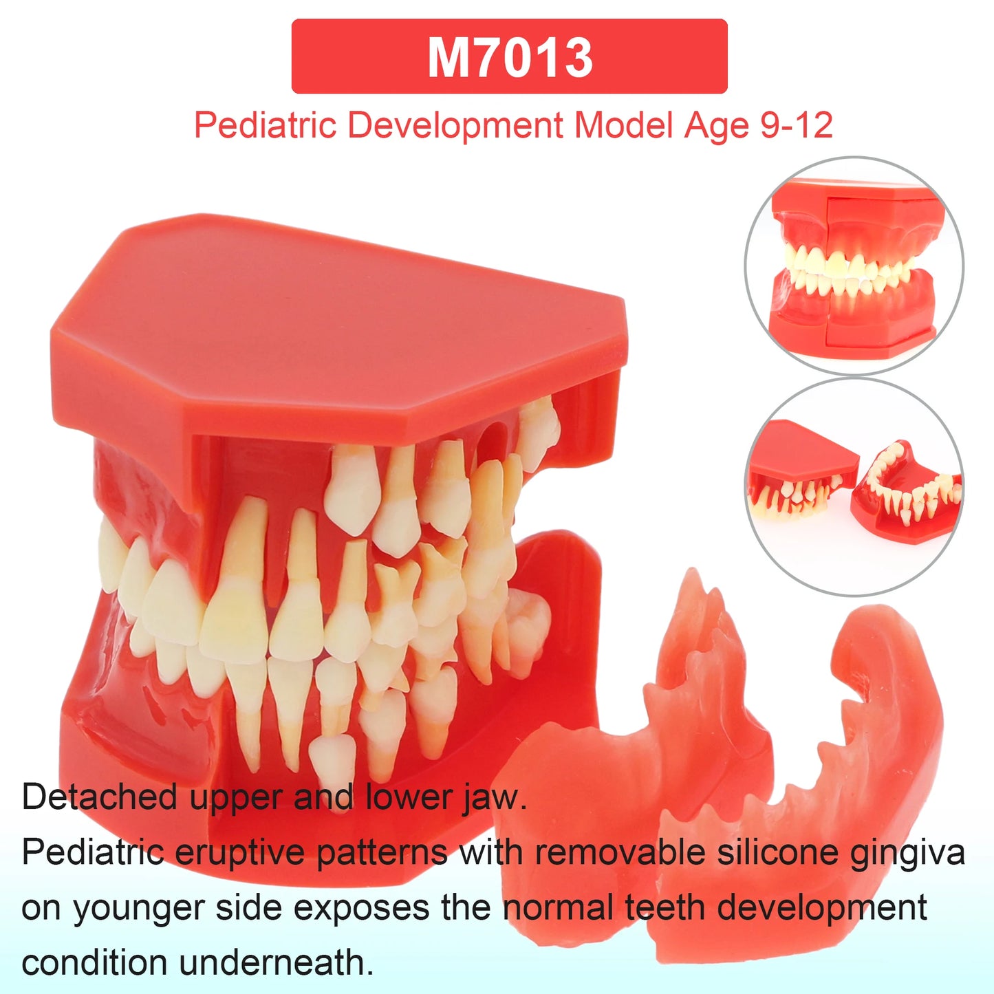 Dental Teeth Model Dental Teaching Models Implant Model Removable Dentistry Model Teeth For Training Studying Patient Education