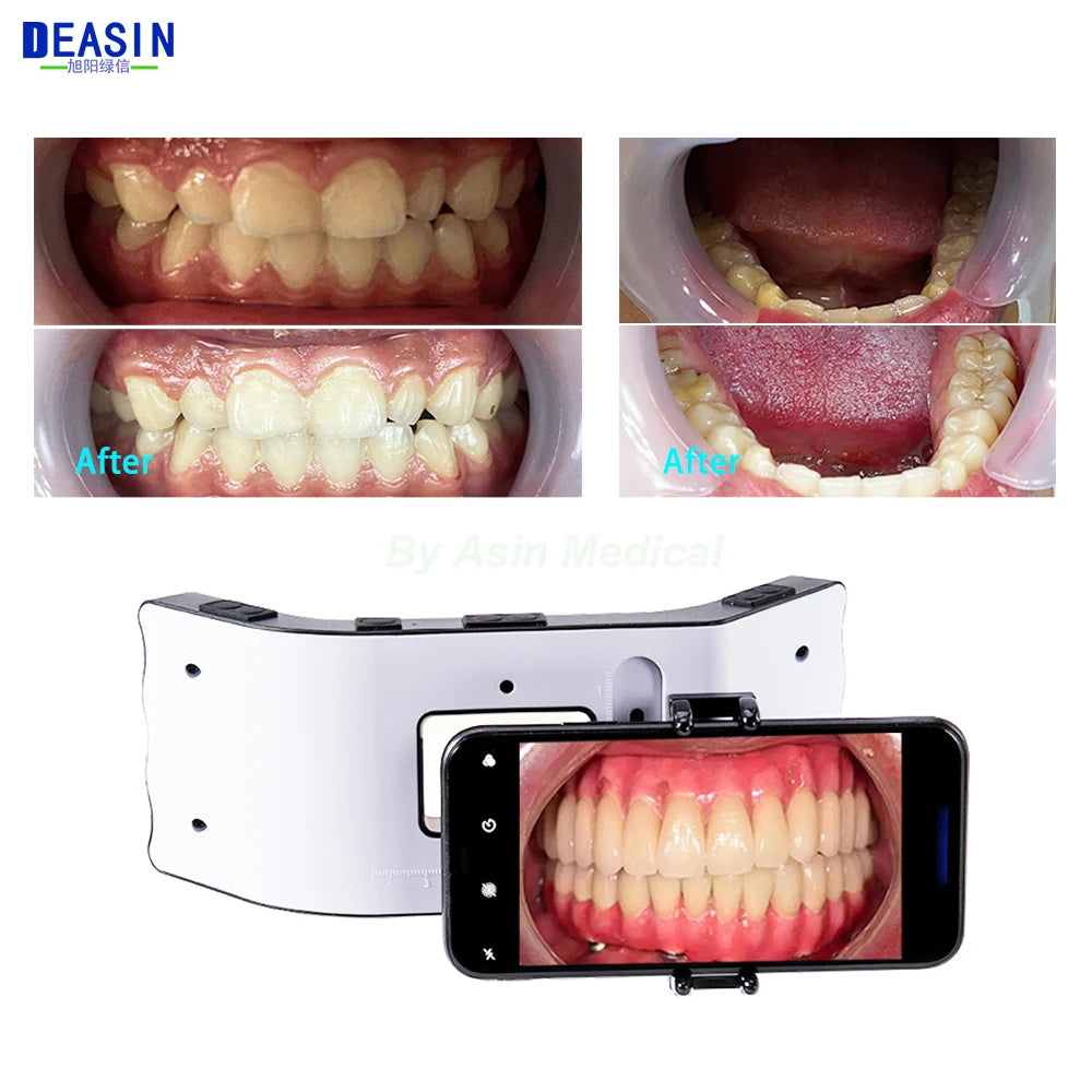 Dental Photography Light LED Oral Filling Lamp Dentistry Photo Video Orthodontics Equipment for Dentist Treatment Lighting