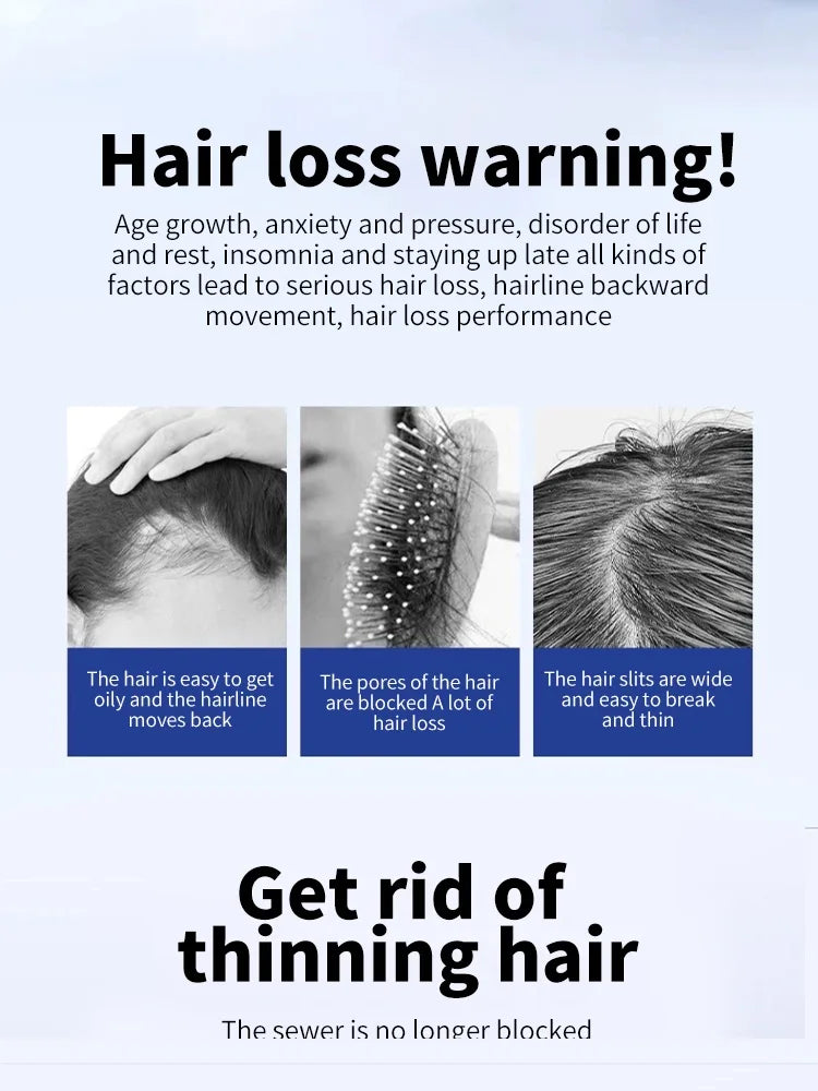 50ml scalp care promoting hair growth essential oil essence health care beauty dense hair growth essence