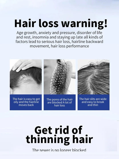 50ml scalp care promoting hair growth essential oil essence health care beauty dense hair growth essence