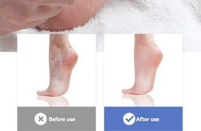 2pcs Feet Scraping Dead Skin Knife Foot Care Knife To Remove Dead Skin Knife Shaving Calluses To Remove Dead Skin Utensils