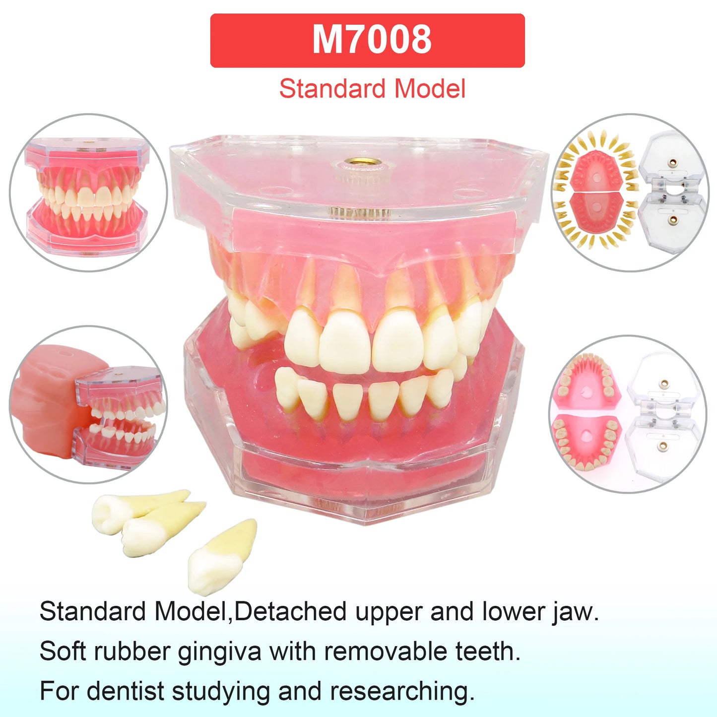Dental Teeth Model Dental Teaching Models Implant Model Removable Dentistry Model Teeth For Training Studying Patient Education