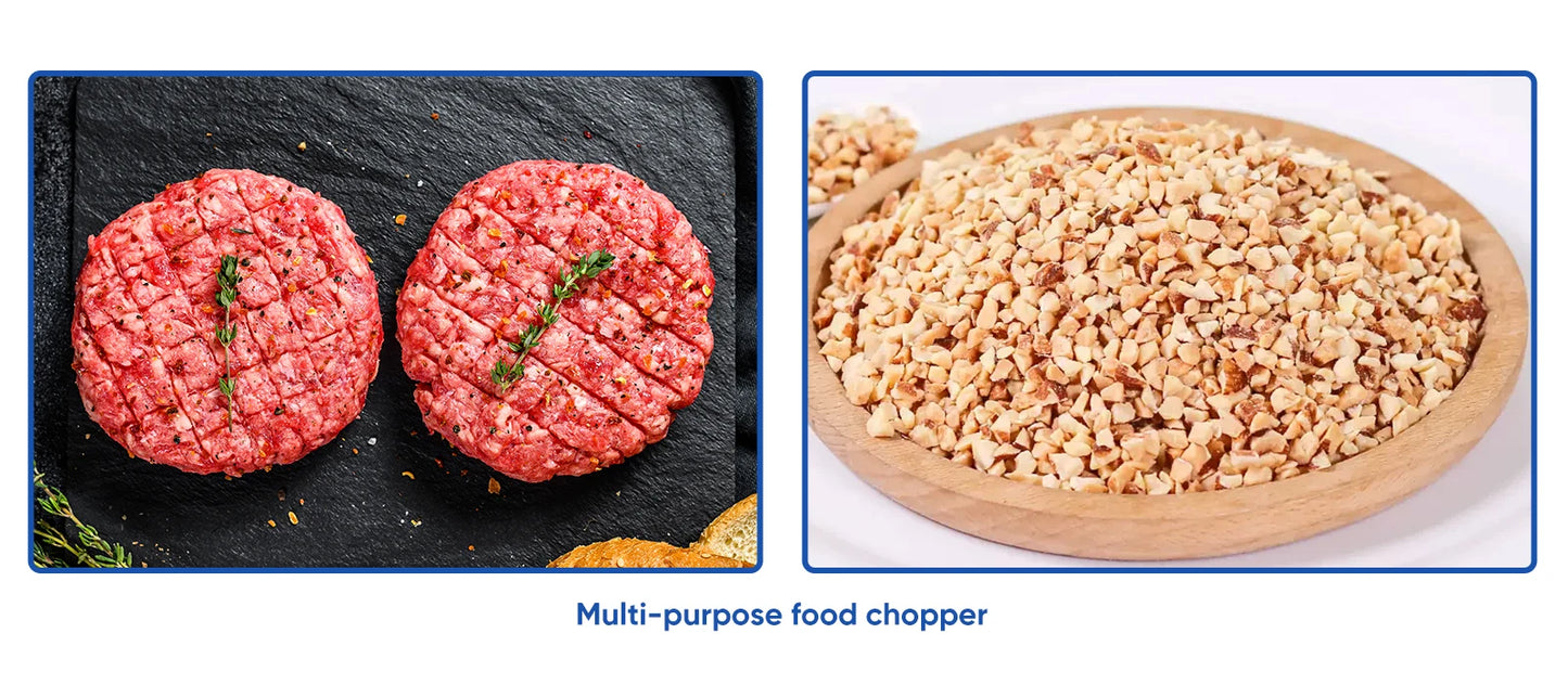 BioloMix 5 in 1 Immersion Hand Blender,1500W Blender with 304 Stainless Steel Blade,Food Processor,Smoothies Puree Baby Food