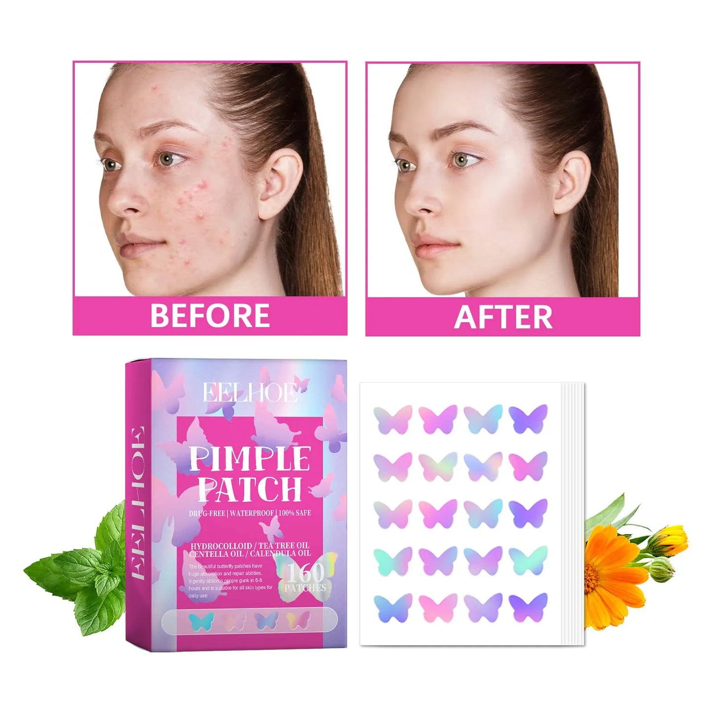 Pimple Patches for Face Cute Butterfly Shaped Acne Patches Hydrocolloid Cute Zit Stickers Parches Para Acne
