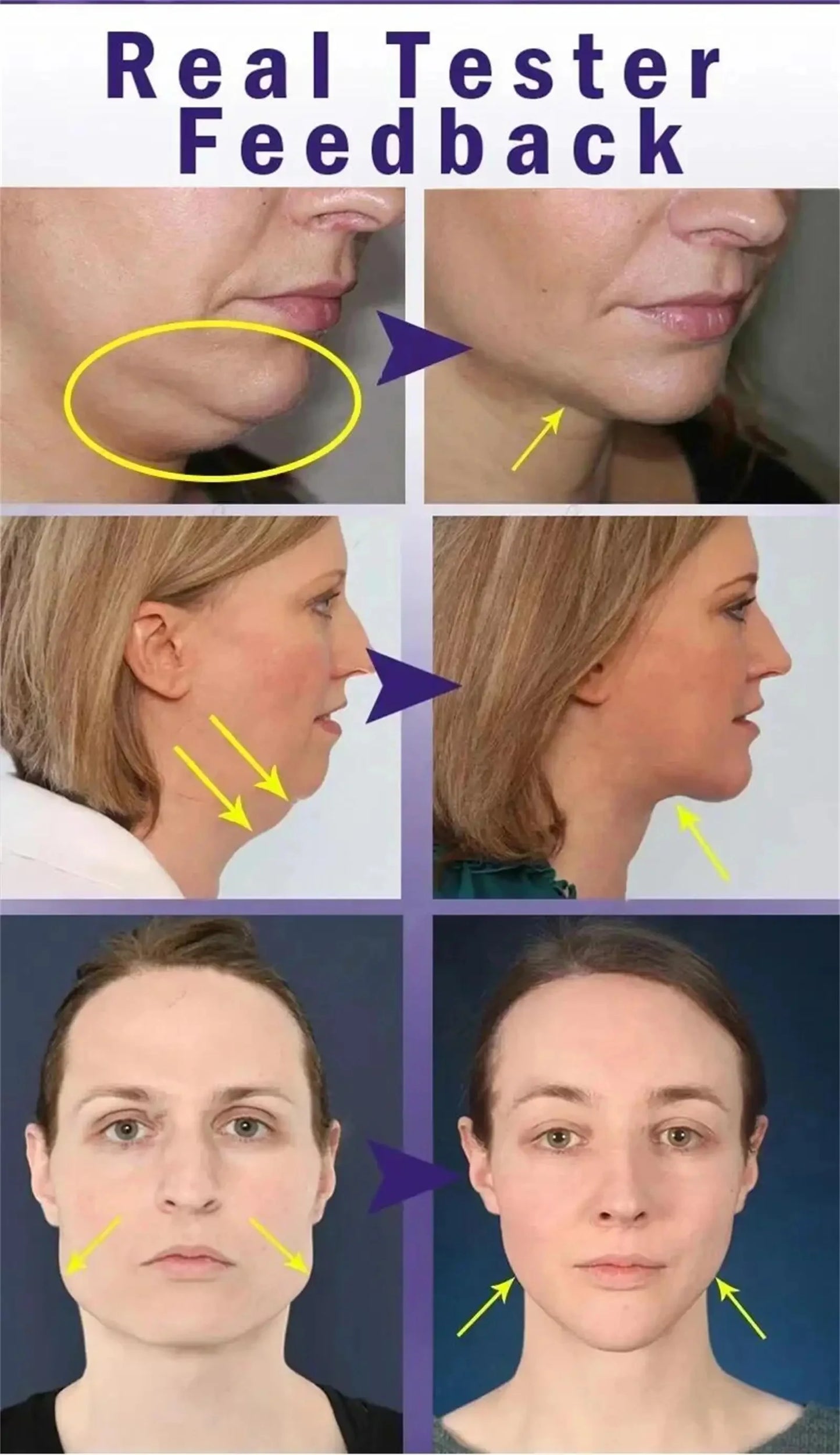 Roller Massager V-Shape Firming Face-lift Slimming Cream Removal Masseter Muscle Double Chin Face Fat Burning Anti-aging Product