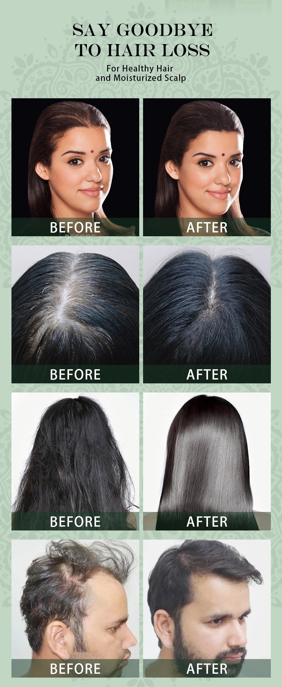 Ayurvedic Hair Growth Oil India Adivasi herbal Hair Growth Oils Anti Hair Loss Fast Regrowth Thicken Serum Hair Growth Products