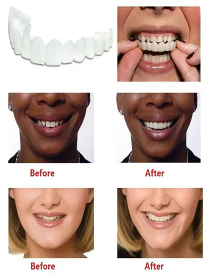 1/2/5Pcs The New Type Of Hole-Free Upper And Lower Teeth Combination Simulation Teeth Whitening Contains Dental Gel/Tweezers