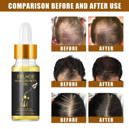 Fast Hair Growth Hair Care Essential Oil Essence Original Authentic Anti-loss Liquid Health Care Beauty Dense Hair Growth Serum