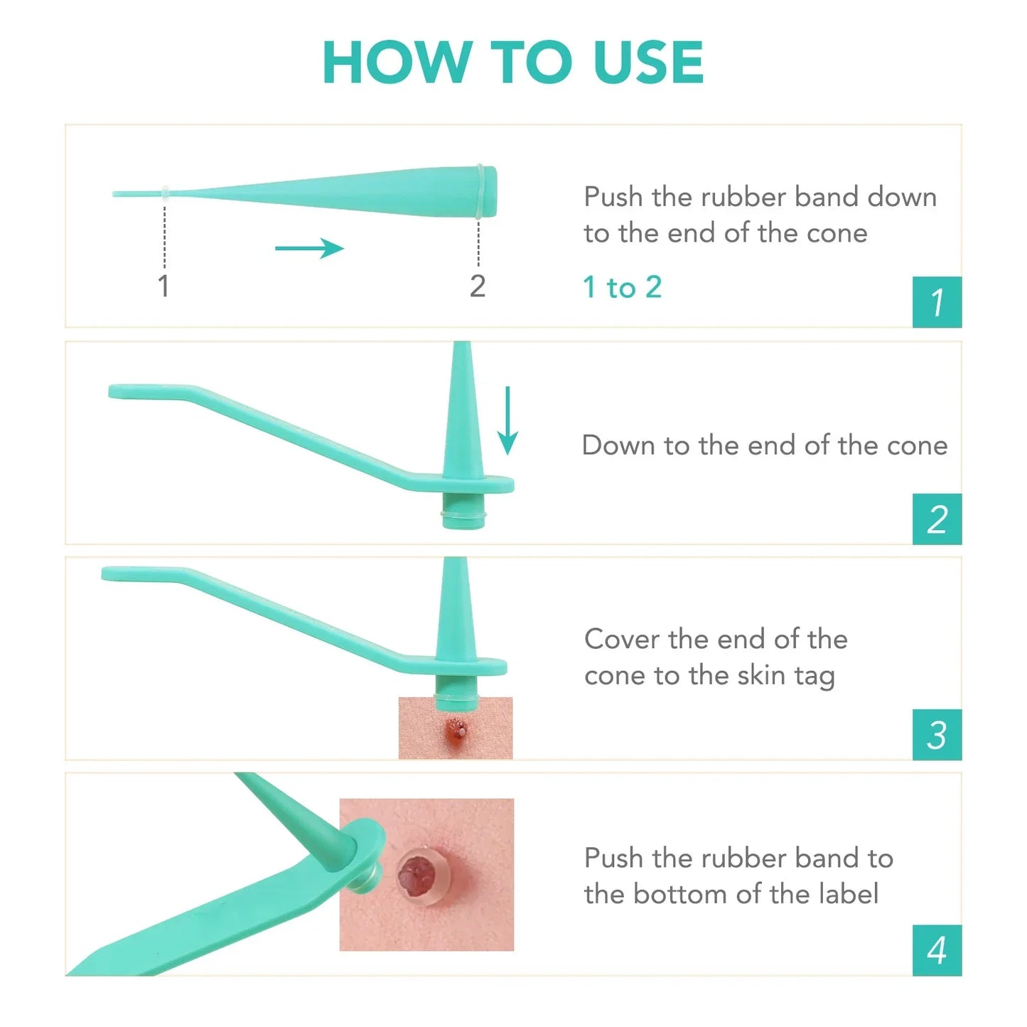 Simple Wart Removal Tool Set Skin Tag Removeal Tool Easy To Clean Skin Care Tool Skin Tag Removal Care Products