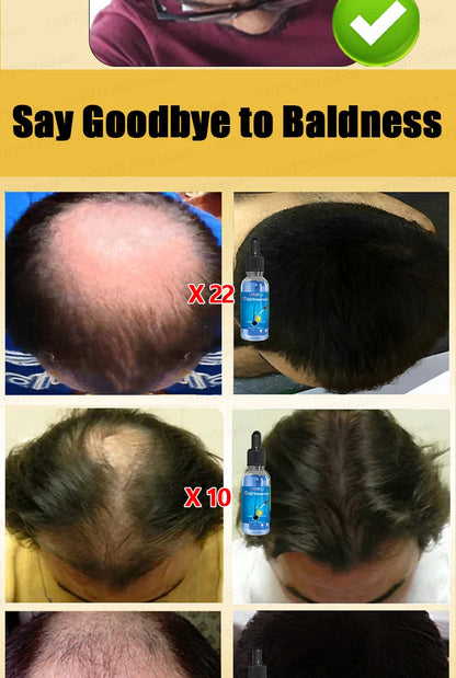 Hair growth essential oil, effectively repair baldness and hair loss, new hair growth