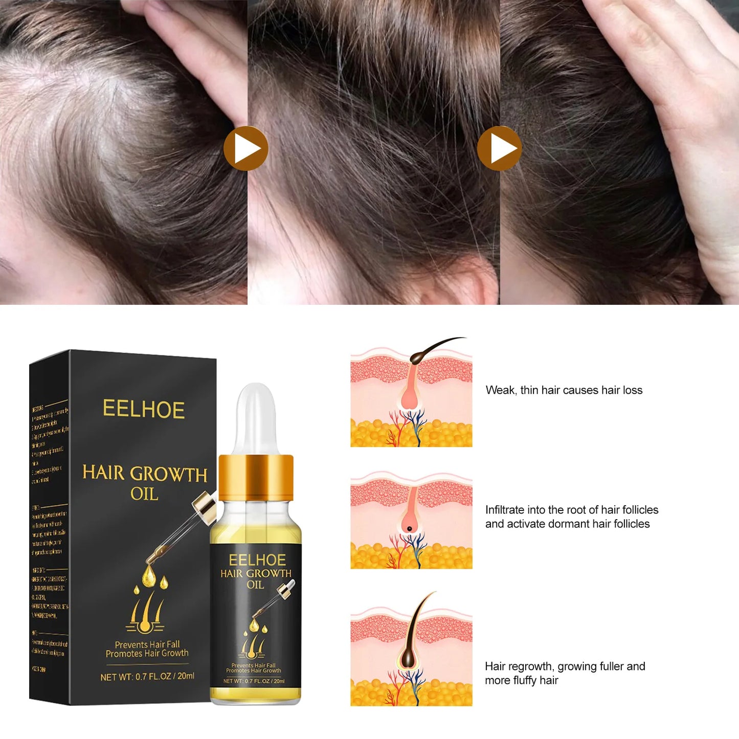 Fast Hair Growth Hair Care Essential Oil Essence Original Authentic Anti-loss Liquid Health Care Beauty Dense Hair Growth Serum