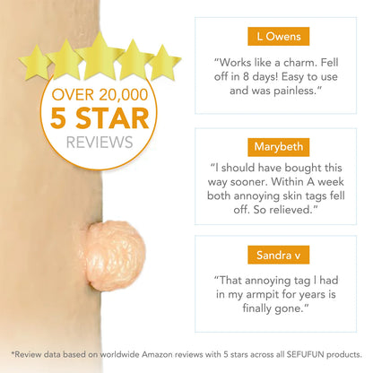 Simple Wart Removal Tool Set Skin Tag Removeal Tool Easy To Clean Skin Care Tool Skin Tag Removal Care Products