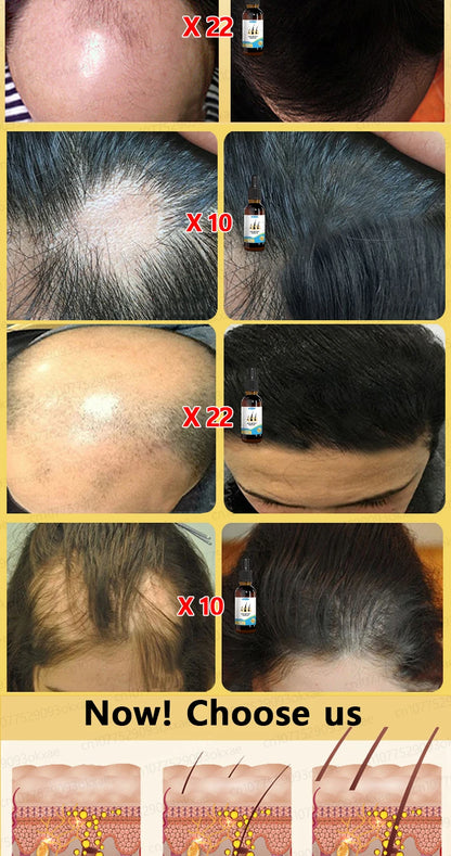The latest hair serum for 2025. Quickly repair hair follicles and say goodbye to hair loss.