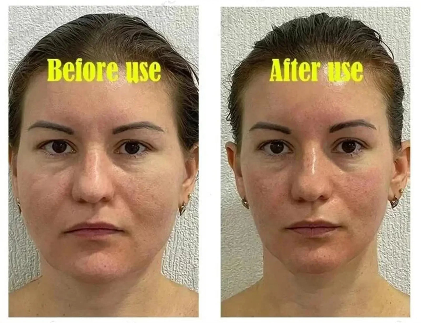 Roller Massager V-Shape Firming Face-lift Slimming Cream Removal Masseter Muscle Double Chin Face Fat Burning Anti-aging Product