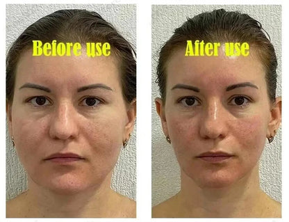 Roller Massager V-Shape Firming Face-lift Slimming Cream Removal Masseter Muscle Double Chin Face Fat Burning Anti-aging Product