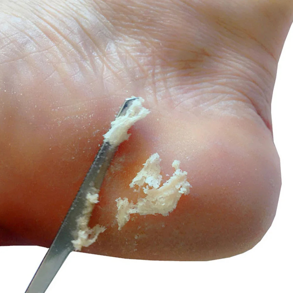 1/2/5Pcs Feet Pedicure Knife Tools Stainless Steel Foot Scrubber Dead Skin Remover Foot Scraper Knife Scraping Manicure Tool
