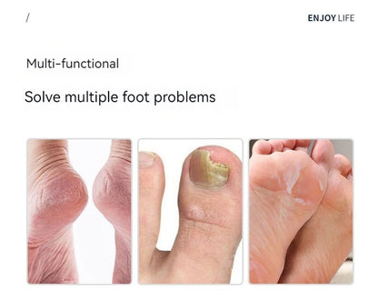 Pedicure Knife Set Of Callus Nail Trimming Tools To Remove Dead Skin Scraper Home Repair Foot Nail Groove Artifacts