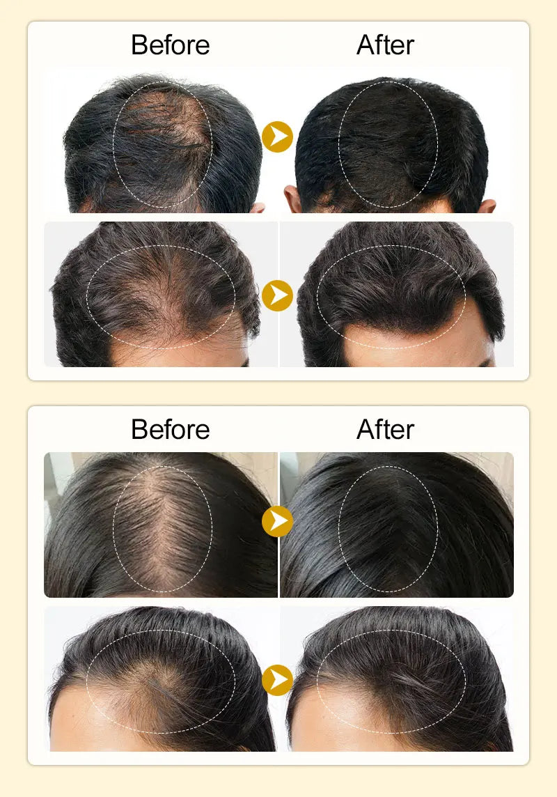 PURC Ginger Hair Serum for Men Women Scalp Treatment Repair Damaged Dry Moisturizing Hair Care Products 50ml