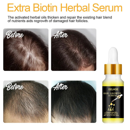 Fast Hair Growth Hair Care Essential Oil Essence Original Authentic Anti-loss Liquid Health Care Beauty Dense Hair Growth Serum