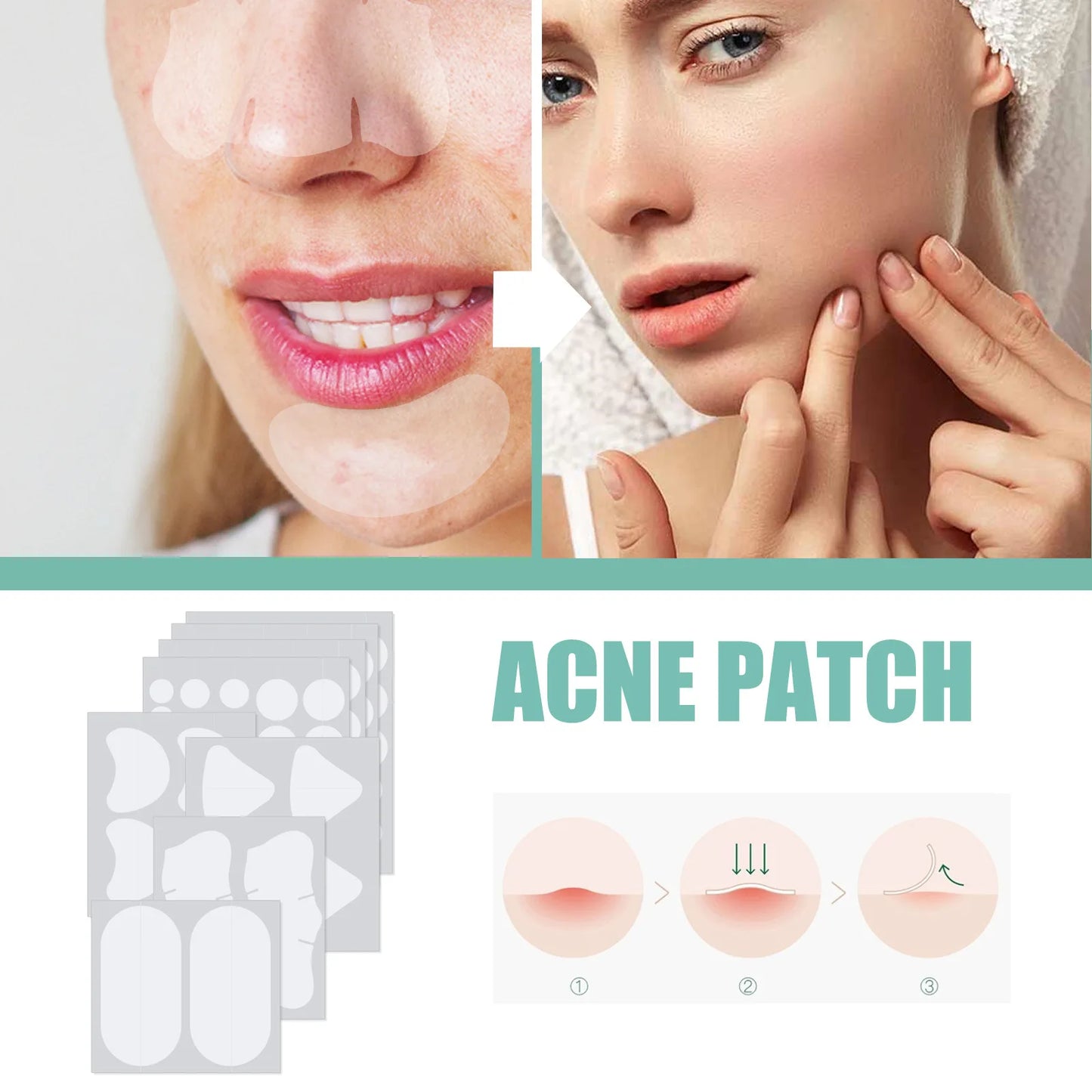 132Pcs Acne Pimple Patches Skin Blemish Treatment  Patches Professional Face Cleaning Care Invisible Large Hydrocolloid Sticker