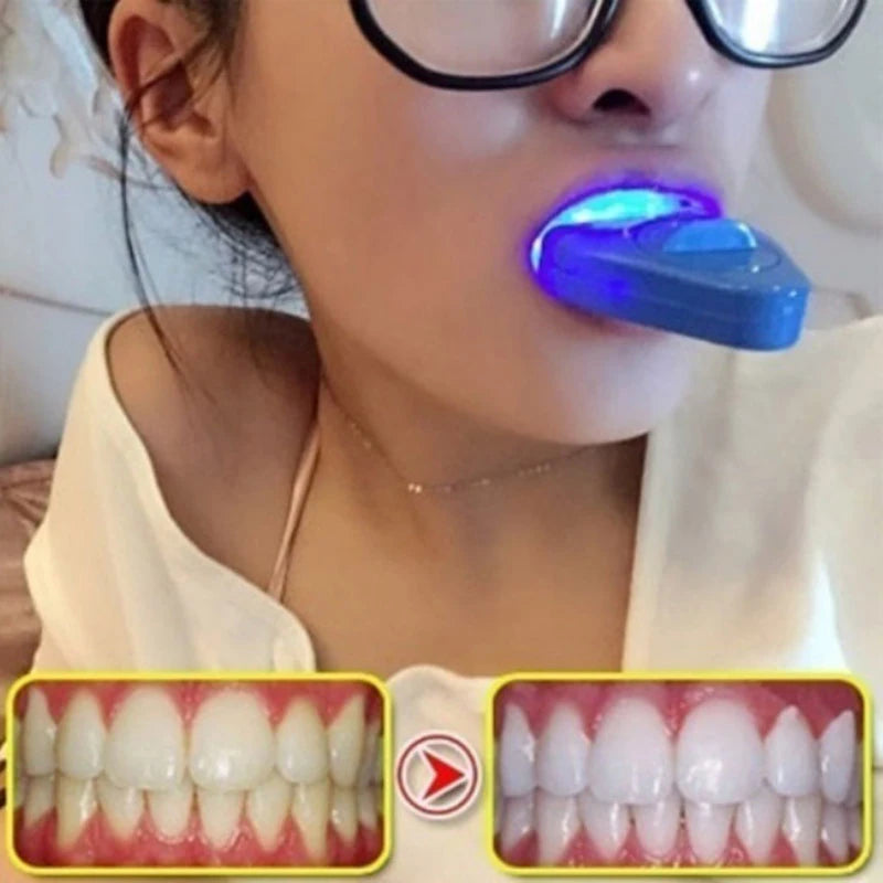 Teeth Light LED Blue Light Whitening Kit Teeth beauty Machine Utilizes Cold Light Technology Personal Dentals Treatments ﻿