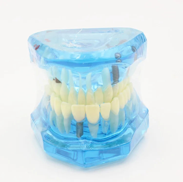 Dental Models Repairable Resin Models Of Diseased Teeth For Teaching And Research In Medicine And Dental Diseases