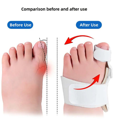 Orthopedic Supplies Pedicure Foot Care Children Toe Separators Big Toe Straightener Bunion Splint Brace Toe Valgus Corrector