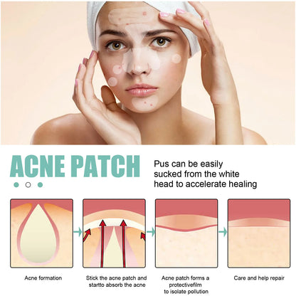 132Pcs Acne Pimple Patches Skin Blemish Treatment  Patches Professional Face Cleaning Care Invisible Large Hydrocolloid Sticker