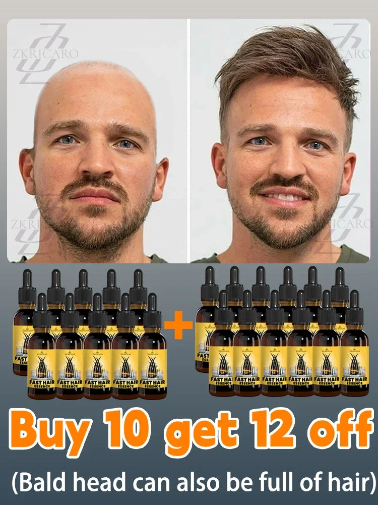 2025 Hair growth oil, repair baldness, hairline, rapid hair growth hair growth oil for men