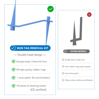Simple Wart Removal Tool Set Skin Tag Removeal Tool Easy To Clean Skin Care Tool Skin Tag Removal Care Products