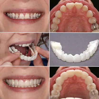 Teeth Veneers Whitening Dentures Braces Temporary False Teeth Cover Perfect Smile Comfortable Fit Denture Kit