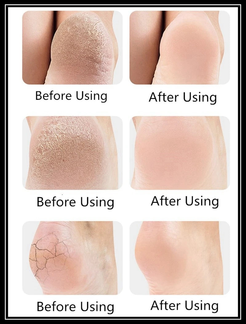 1 Pair Silicone Rubber Gel Socks Anti Cracking Liner Heel Socks Elastic Silicon Moisturizing Foot Skin Care Heel Foot Protection