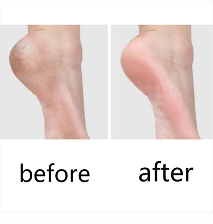 1/2/5Pcs Feet Pedicure Knife Tools Stainless Steel Foot Scrubber Dead Skin Remover Foot Scraper Knife Scraping Manicure Tool