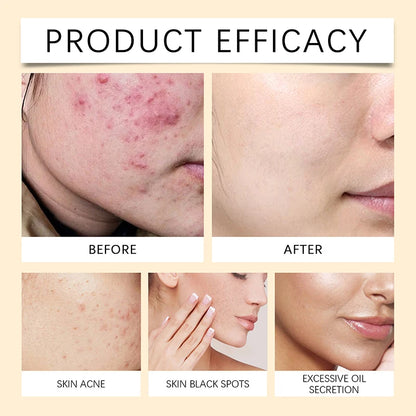 Beauty Rice Honey Facial Skincare 3pieces Set Moisturizing Arbutin Serum Milk Toner Smear Glow Mask Korean Brand Facial Skincare