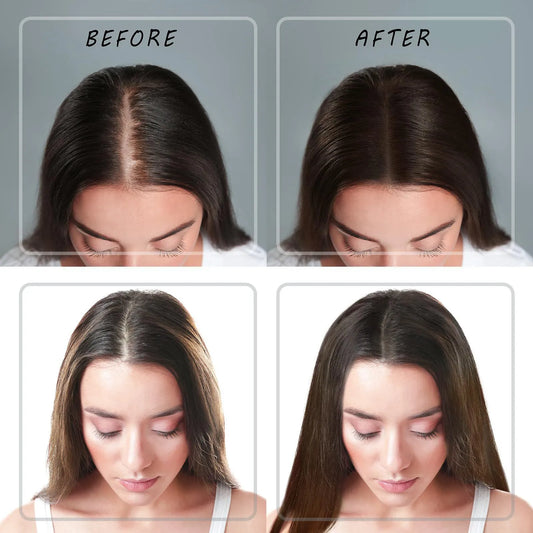 Vegan Hair Growth Oil Natural Vegan Hair Growth Oil For Dry And Damaged Hair Vegan Hair Growth Oil For Dry And Damaged Hair30ml