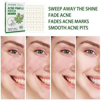 144pcs Acne Pimple Patches Translucent Matte Hydrocolloid Salicylic Acid Tea Tree Oil For Inflamed Acne Improve Whiteheads