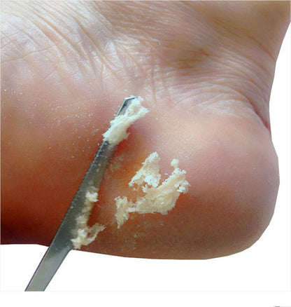 1/2/5Pcs Feet Pedicure Knife Tools Stainless Steel Foot Scrubber Dead Skin Remover Foot Scraper Knife Scraping Manicure Tool