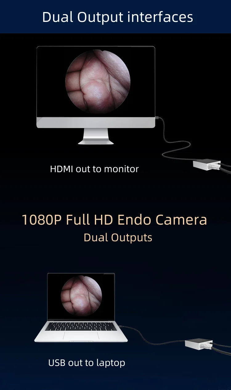 Surgical Medical ENT Endoscope Camera Portable Full HD Endoscopy Camera With HDMI And USB Output Surgical Veterinary Surgery