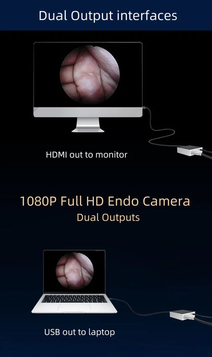 Surgical Medical ENT Endoscope Camera Portable Full HD Endoscopy Camera With HDMI And USB Output Surgical Veterinary Surgery