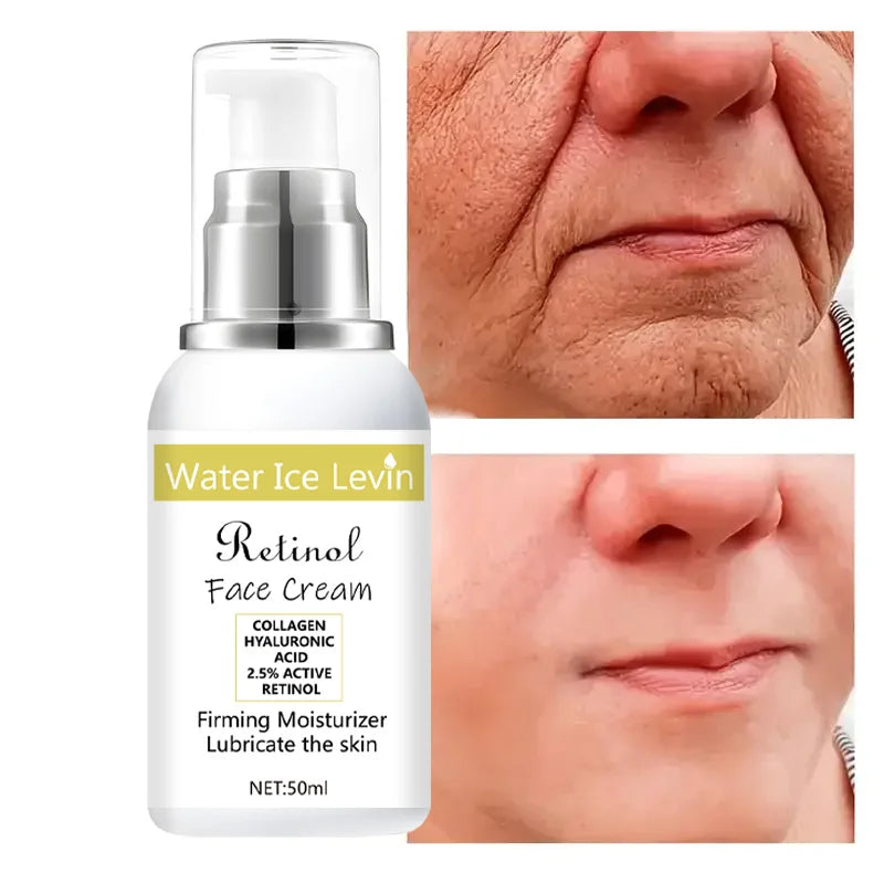 Retinol Cream, Collagen, Hyaluronic Acid, Retinol and Niacinamide Moisturizing and Nutrition, Soft, Elasticity, Vitality and Peeling Skin