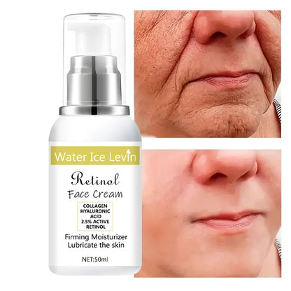 Retinol Cream, Collagen, Hyaluronic Acid, Retinol and Niacinamide Moisturizing and Nutrition, Soft, Elasticity, Vitality and Peeling Skin