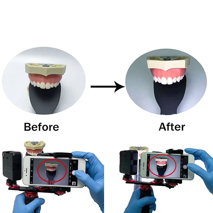 Dental Photography Equipment LED 2 In 1 Oral Filling Lamp Orthodontics Flash Light for Dentist Photo Fill Intraoral light