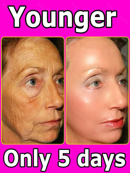 Make you look younger and young