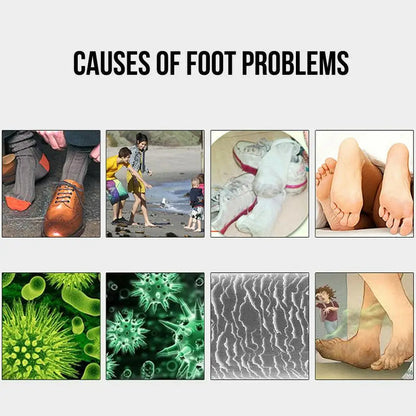 Socks Shoes Deodorant Spray Shoes Stink Freshener Socks Odor Remover Spray Refresh Antiperspirant Foot Sweat Odor Remover