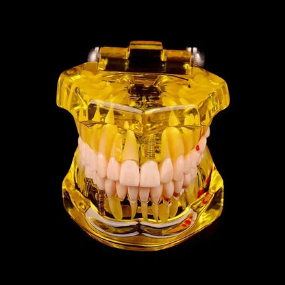 Dental Models Removable And Restorable Models Of Diseased Teeth For Teaching And Researching Medical And Dental Diseases