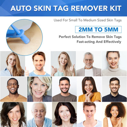 Simple Wart Removal Tool Set Skin Tag Removeal Tool Easy To Clean Skin Care Tool Skin Tag Removal Care Products