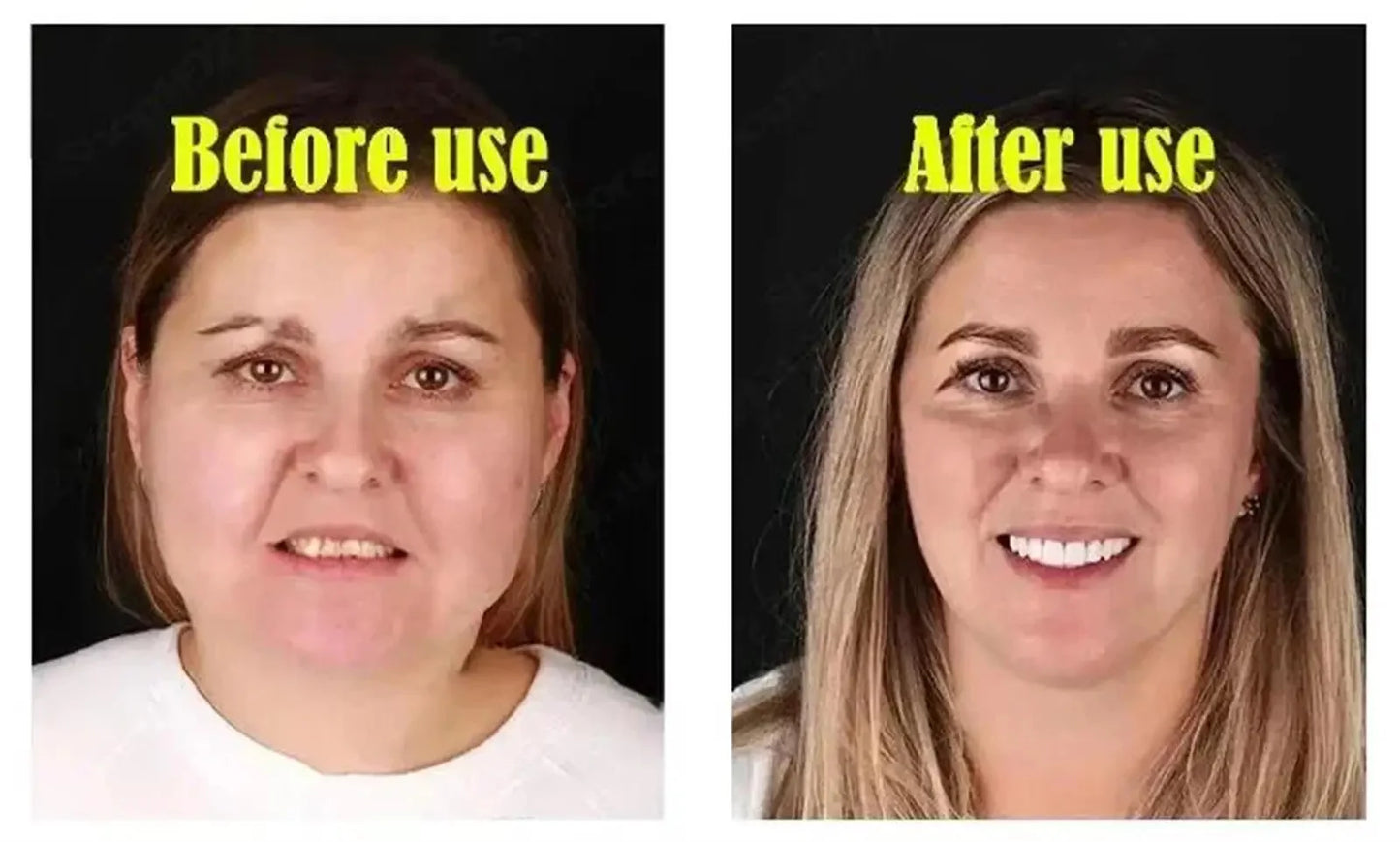 Roller Massager V-Shape Firming Face-lift Slimming Cream Removal Masseter Muscle Double Chin Face Fat Burning Anti-aging Product