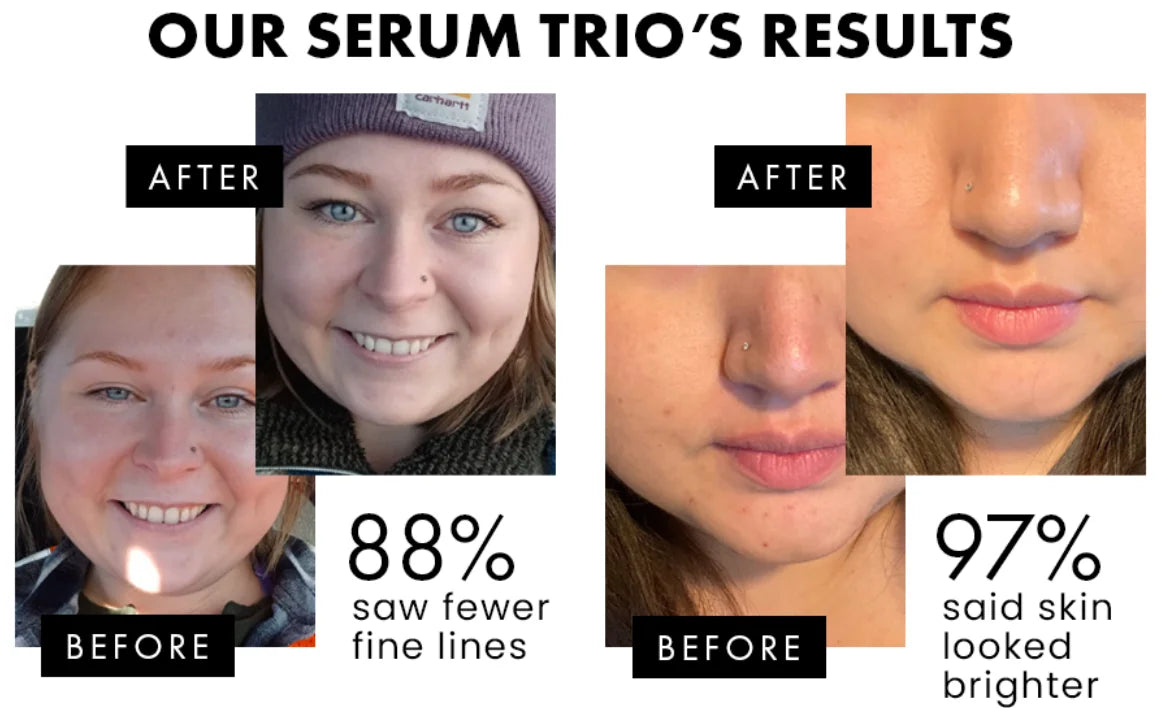 Facial Serums Skin Care Set  Moisturizing Retinol +Hyaluronic Acid + Vitamin C Serum Brightening Firming, & Hydrating Face Serum